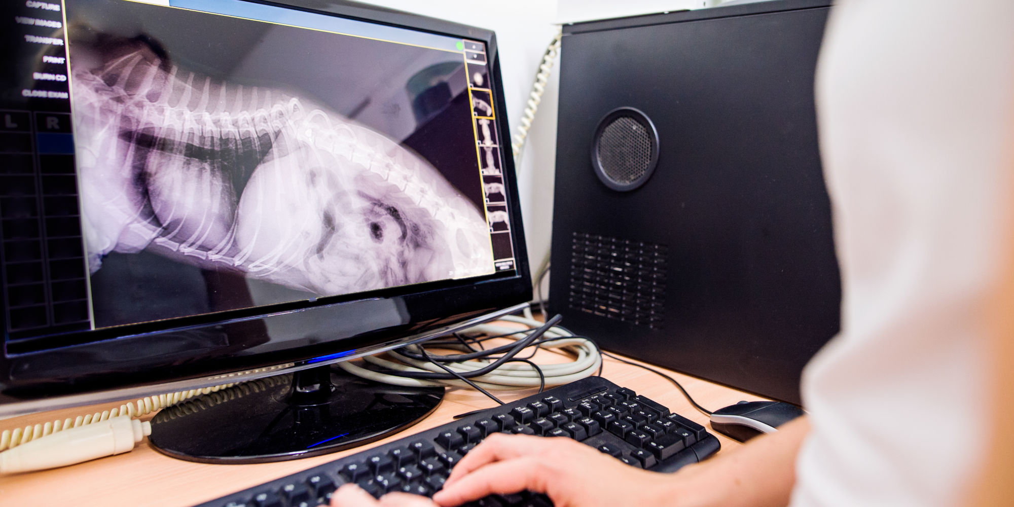 Digitales Röntgenbild auf Bildschirm Diagnose Bewegungsapparat